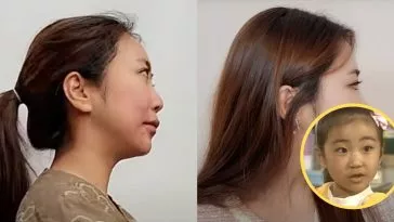 Уже известная повзрослевшая детская актриса рассказывает о своей недавней операции на носу